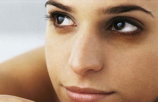 fashionnostop dark circles skin