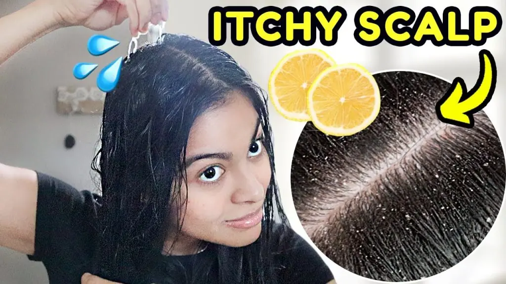Beautynfacts lemon for dandruff