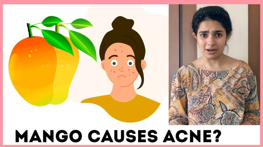 beautynfacts Myth Vs Fact Can Mangoes Cause Acne