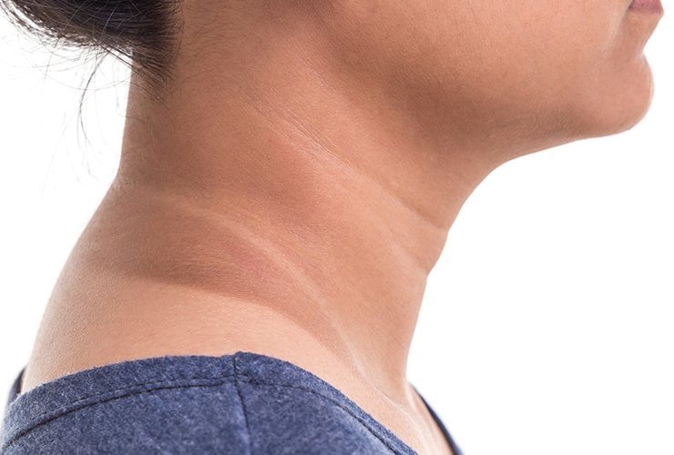 beautynfacts Why Does the Neck Darken