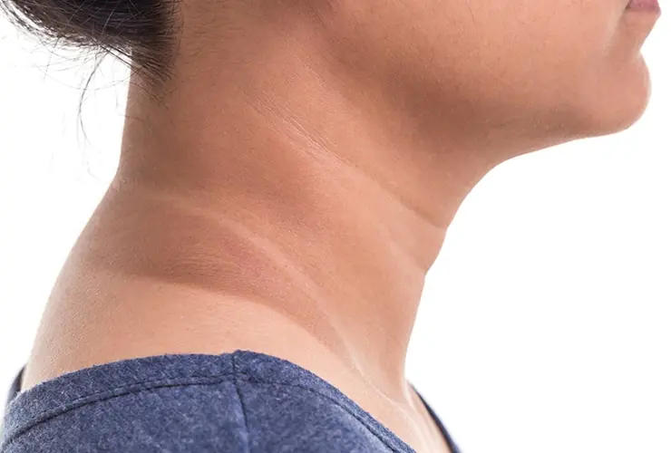 Beautynfacts why does the neck darken