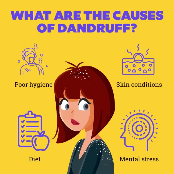 Eliminate dandruff naturally