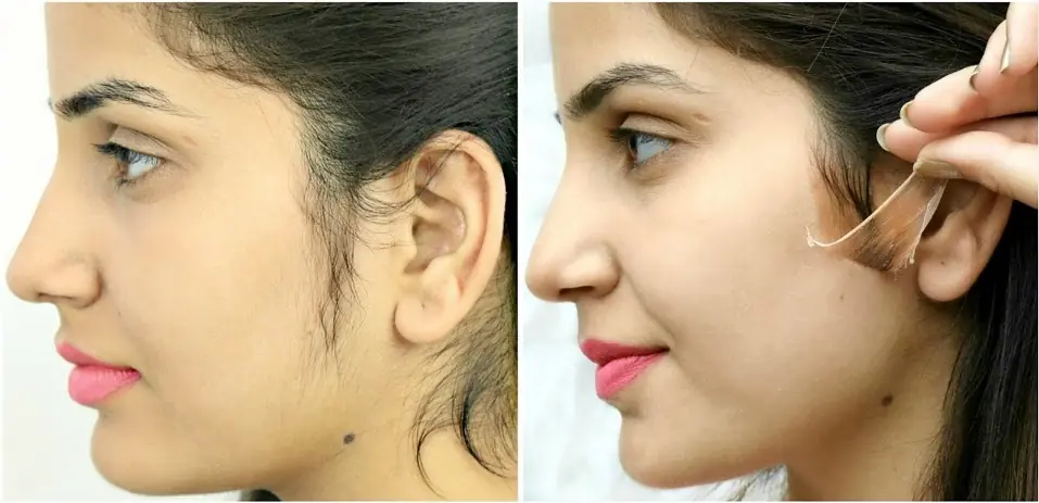 Beautynfacts. Com home remedy for facial hair removal