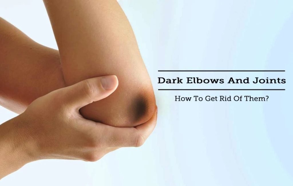 beautynfacts.com How to remove black from elbows