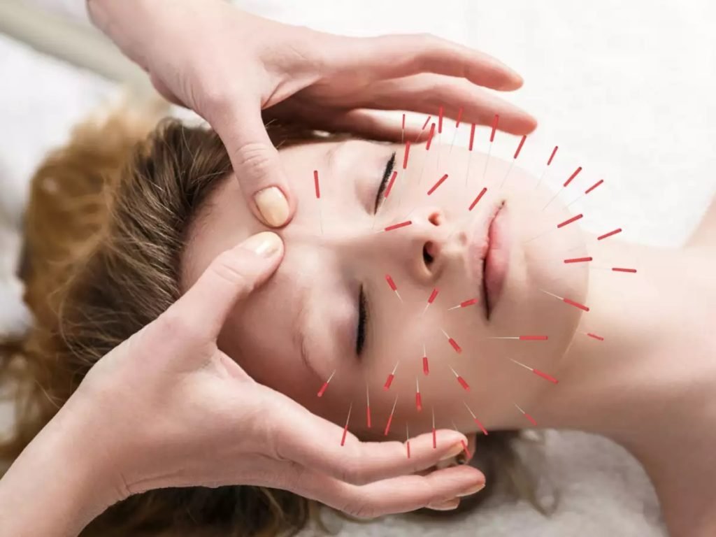 beautynfacts.com Understanding Acupuncture A Brief Overview