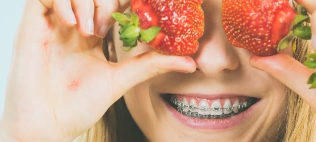 beautynfacts.com foods for teeth braces