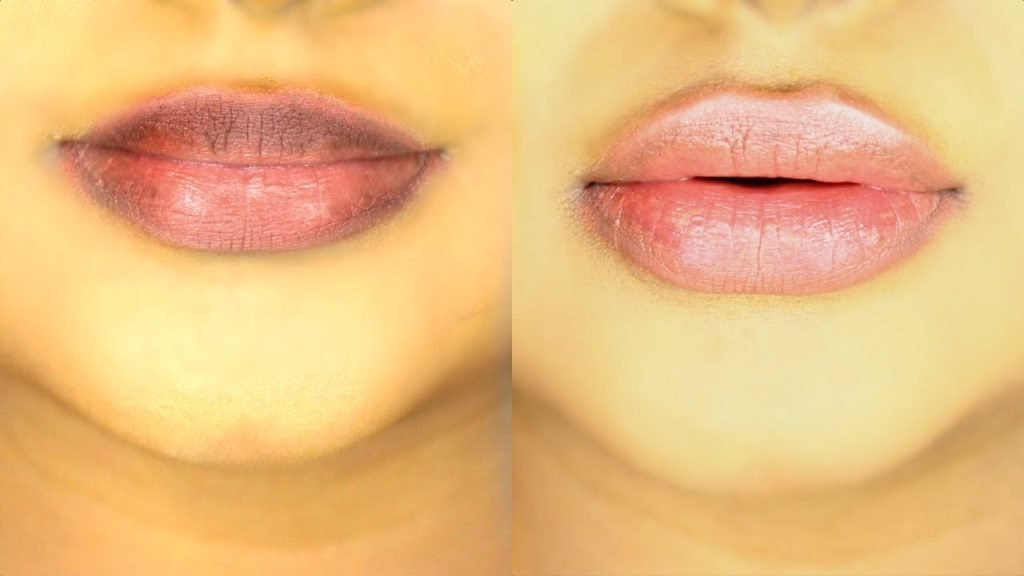 www.beautynfacts.com Causes of Dark Lips