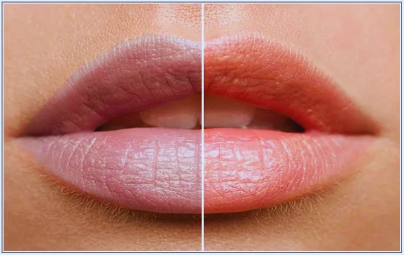 Www. Beautynfacts. Com products to use for lightening dark lips