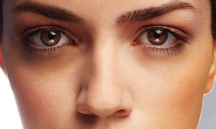 beautynfacts Dark Circles How To Get Rid Of Them