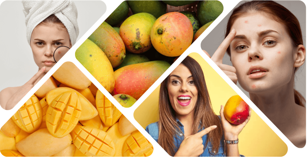 beautynfacts Mangoes Cause Acne