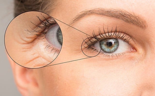 beautynfacts Say Goodbye to Eye Wrinkles