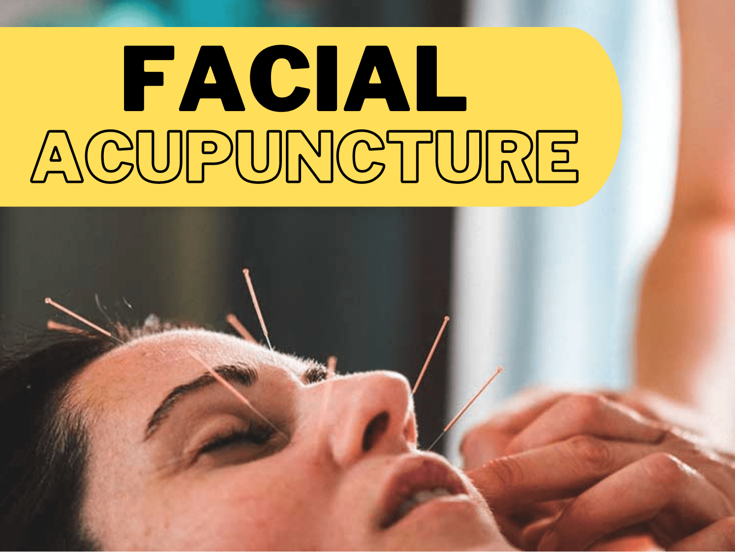 How Does Acupuncture Affect Your Facial Appearance? How Does Acupuncture Affect Your Facial Appearance?