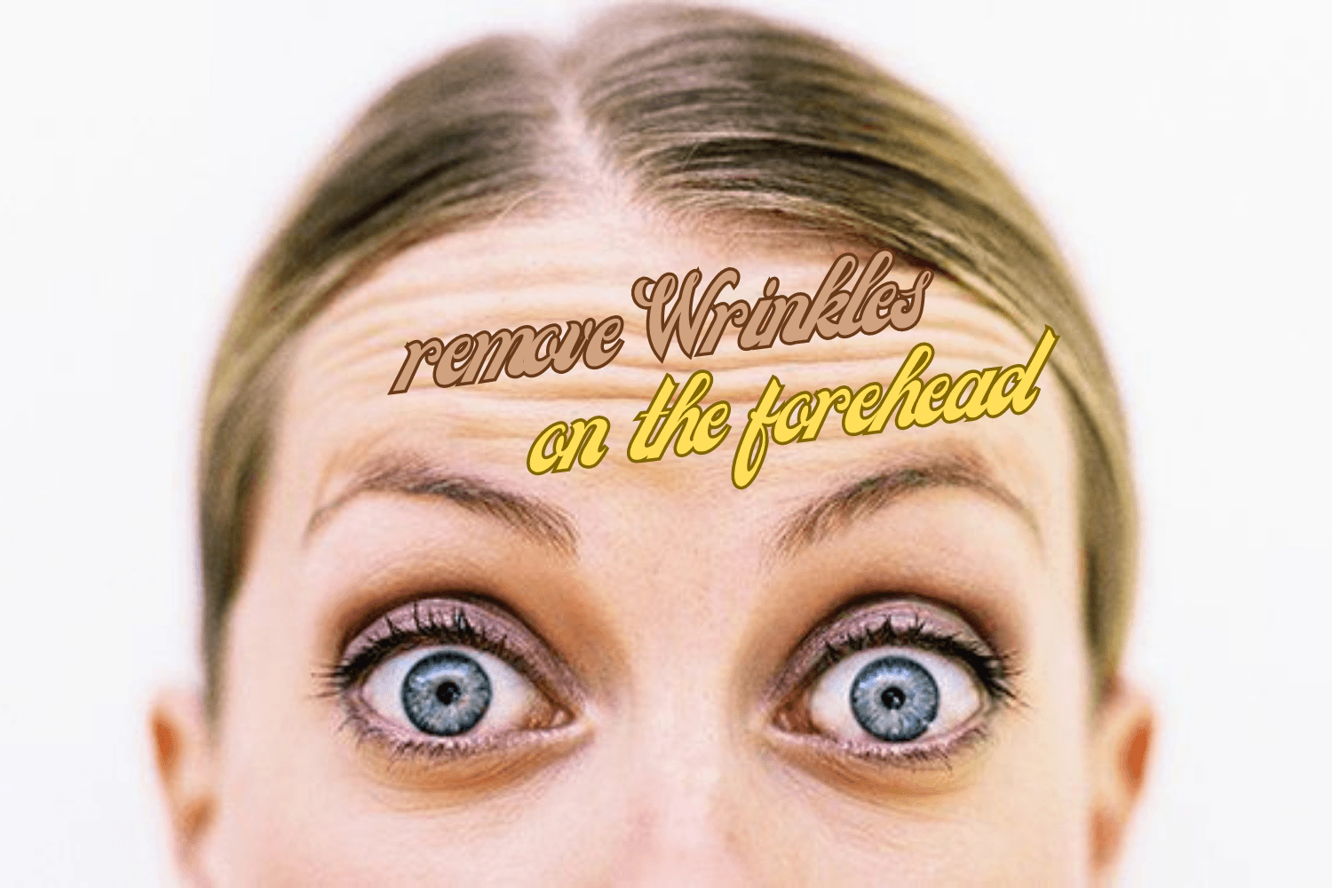 How to Remove Forehead Wrinkles Naturally and Effectively : Proven Tips and Treatments for Smoother Skin How to Remove Forehead Wrinkles Naturally and Effectively : Proven Tips and Treatments for Smoother Skin
