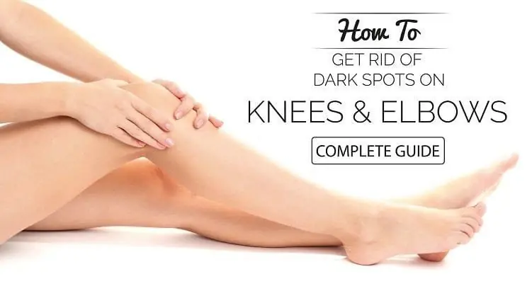 How to Remove Dark Elbows: 9 Proven Treatments That Actually Work