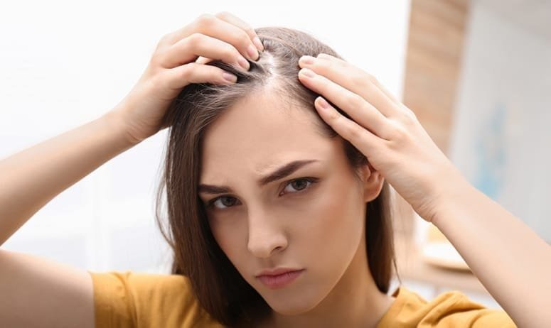 fashionnostop Scalp Psoriasis