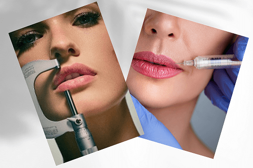 fashionnostop lips augmentation