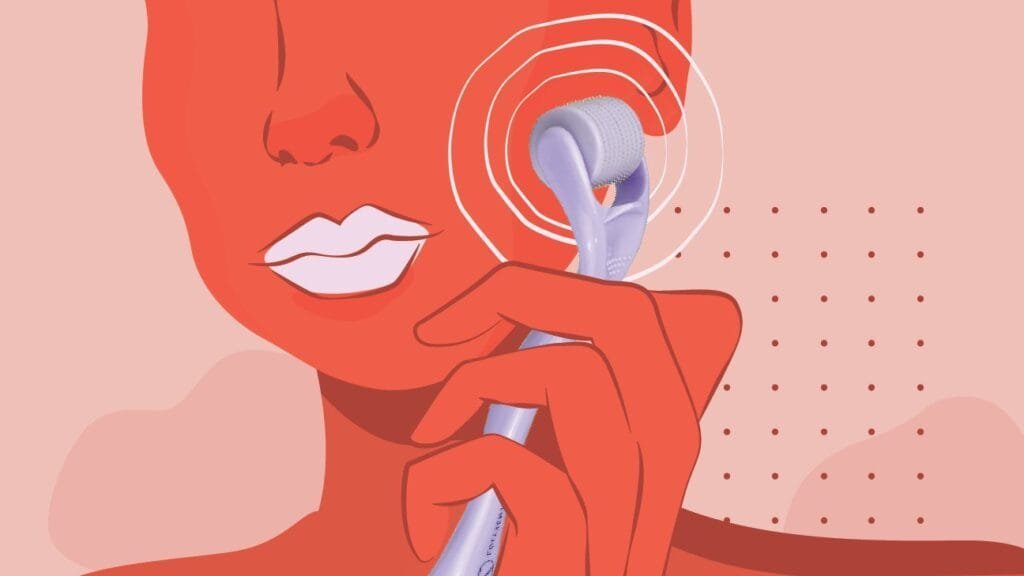 |fashionnostop microneedling @ home
