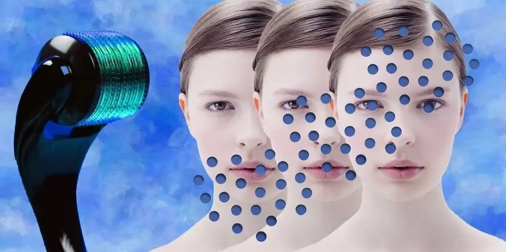 Wrinkles and Acne Scars: Microneedling at Home That Actually Works