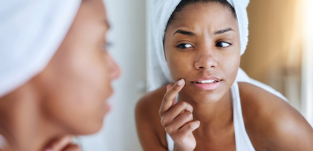 Spot Treatments: Goodbye to That Horrible Pimple! Spot Treatments: Goodbye to That Horrible Pimple!