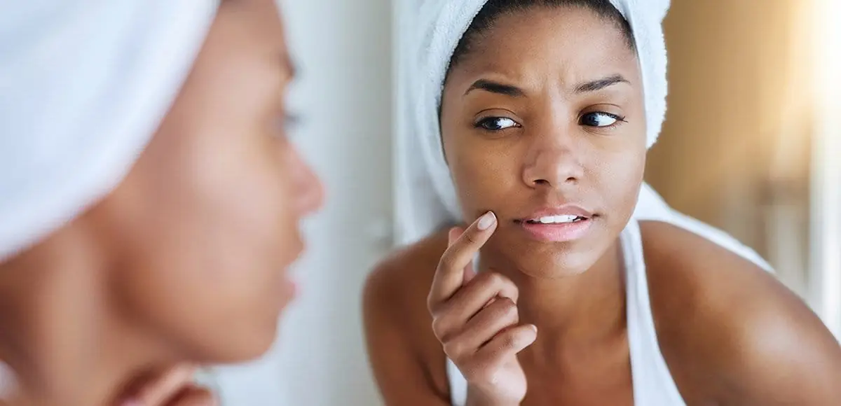Spot Treatments for Pimples: How to Shrink a Breakout Fast Spot Treatments for Pimples: How to Shrink a Breakout Fast