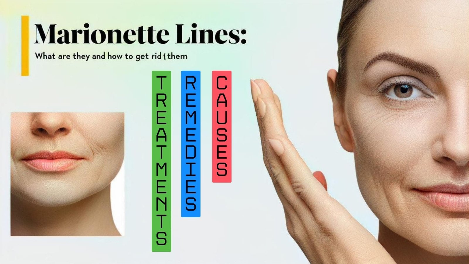 Marionette Lines: What Are They and How to Get Rid of Them Marionette Lines: What Are They and How to Get Rid of Them