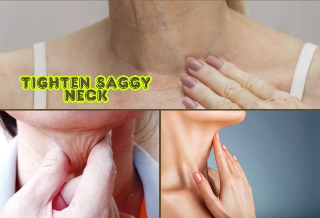 How to Tighten Saggy Neck Skin Without Getting Surgery