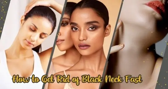 How to Get Rid of Black Neck Fast: Proven Tips New vs Traditional How to Get Rid of Black Neck Fast: Proven Tips New vs Traditional