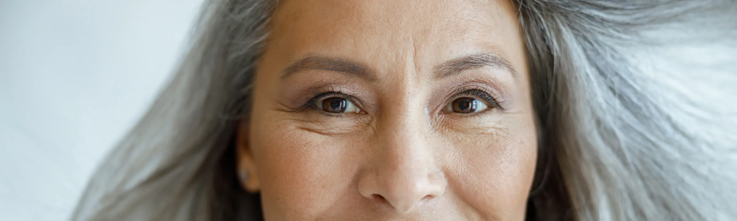 Premature aging & fine lines